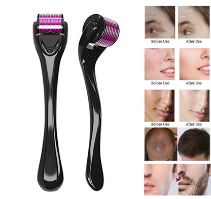 Derma Roller| Micro Needling Treatment